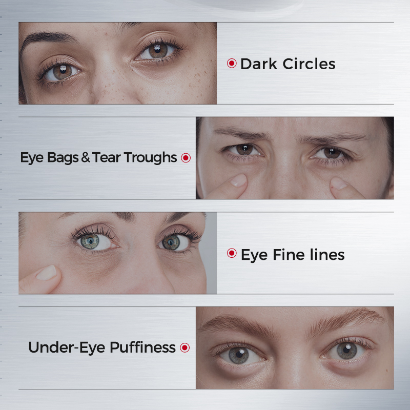 Eye Patches for Dark Circles – - Collagen Eye Patch 评论和价格